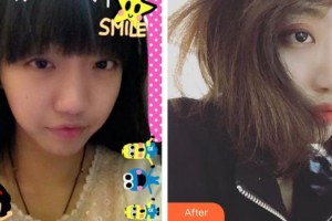 第四軍醫(yī)大學(xué)唐都醫(yī)院整形激光美容中心趙新華整形價格表附鼻部綜合案例展示