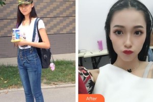 第四軍醫(yī)大學(xué)唐都醫(yī)院整形激光美容中心李金清整形價格表附假體隆鼻案例展示