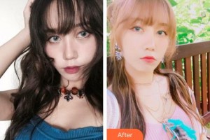 中國醫(yī)科大學(xué)航空總醫(yī)院皮膚激光整形美容中心顧軍整形價格表附清潔祛痘案例展示