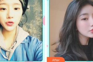 中國醫(yī)藥城醫(yī)院微創(chuàng)整形美容中心朱寧文整形價格表附光子嫩膚案例展示