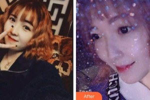 福清天寶美容醫(yī)院蔡黎光整形價格表附超聲波潔牙案例展示