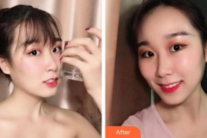 象山華美整形美容醫(yī)院趙誠厚整形價格表附牙齒隱形矯正案例展示