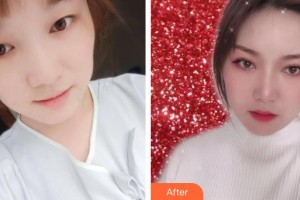 象山愛爾眼科醫(yī)院賈知微整形價格表附埋線雙眼皮案例展示