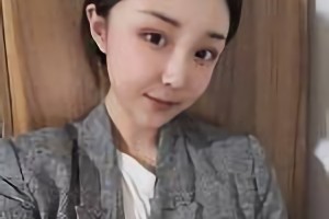 上海華美醫(yī)院的李志海醫(yī)生靠譜嗎？附磨骨案例分享