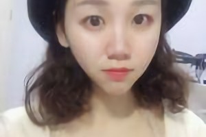 上海華美醫(yī)院李志海做磨骨手術怎么樣?。扛绞中g過程分享