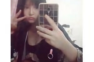 上海華美醫(yī)院李志海做的下頜角貴嗎？附案例日記分享