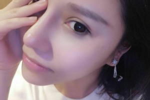 同濟大學附屬東方醫(yī)院醫(yī)生團隊如何？附隆鼻手術(shù)附果圖展示