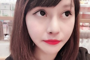 河北醫(yī)科大學(xué)第二醫(yī)院整形美容科隆鼻果好不好附案例和價(jià)格表