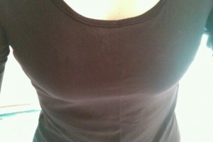 上海交通大學醫(yī)學院附屬第九人民醫(yī)院隆胸手術(shù)果太好了附價格表