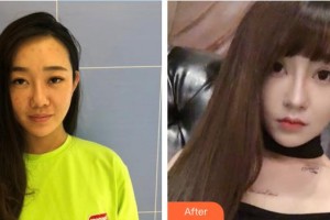 郴州維納斯醫(yī)療美容醫(yī)院黃致遠(yuǎn)整形價(jià)格表附無(wú)針?biāo)獍咐故?>
</a>
<h3 class=