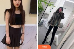 郴州美科醫(yī)療美容門(mén)診部彭奪斌整形價(jià)格表附激光祛疤案例展示