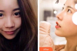 郴州冠華口腔醫(yī)院宋麗沙整形價(jià)格表附鼻部綜合案例展示