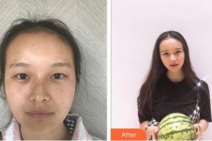 樂清牙科醫(yī)院黃鴿整形價格表附牙貼面案例展示