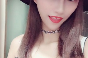 杭州維多利亞整形醫(yī)院許鳳芝隆鼻手術(shù)附果圖