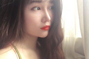 哈爾濱醫(yī)大二院美容科劉國(guó)鋒隆鼻手術(shù)附果圖