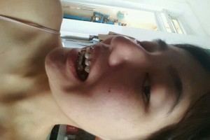 歡樂口腔醫(yī)院孫延牙齒矯正？醫(yī)生推薦+費(fèi)用表