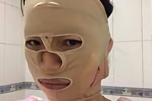 重慶時光整形美容醫(yī)院姜民范磨骨手術(shù)果怎么樣附較新價格表