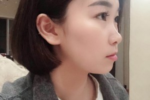 長沙美奧口腔醫(yī)院環(huán)境怎么樣熊安鳳牙齒矯正附果圖和價(jià)格表