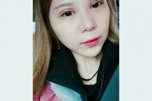 徐州市中心醫(yī)院整形美容中心賀小虎技術(shù)好不好附割雙眼皮案例