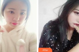 黃河中心醫(yī)院整形美容中心杜楓整形價(jià)格表附鼻部綜合案例展示