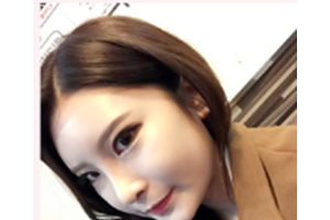 泉州市第一醫(yī)院口碑怎么樣林偉年隆鼻日記分享附價(jià)格一覽