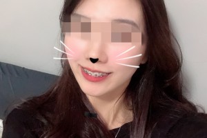 北京深圳大學(xué)醫(yī)院環(huán)境怎么樣牙齒矯正果分享附價(jià)格一覽