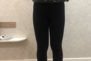 湖南省人民醫(yī)院整形醫(yī)院李高峰吸脂瘦腿果太棒了附2021價(jià)格表