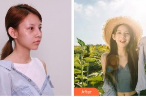 雞西王醫(yī)生整形外科門(mén)診部呂睿纮整形價(jià)格表附硅膠隆鼻案例展示