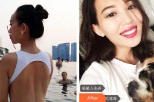 雞西王醫(yī)生整形外科門診部郝國(guó)梁整形價(jià)格表附牙齒陶瓷矯正案例展示