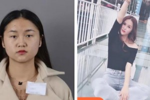 咸陽(yáng)彩虹醫(yī)院整形美容科羅曼整形價(jià)格表附切開(kāi)雙眼皮案例展示