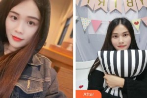 龍口光明眼科醫(yī)院尤力整形價(jià)格表附眼部綜合案例展示