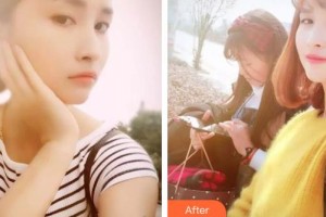 濟(jì)源向日葵口腔門診部王建麗整形價(jià)格表附牙貼面案例展示