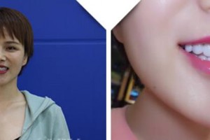 大理麗顏醫(yī)學(xué)整形美容診所陳方中整形價(jià)格表附牙貼面案例展示