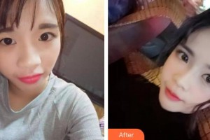 大理韓美醫(yī)療美容醫(yī)院李建剛整形價格表附無針?biāo)獍咐故?>
</a>
<h3 class=