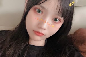 豐臺(tái)右安門醫(yī)院顴骨手術(shù)|附果圖+新版價(jià)格表