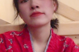 北京聯(lián)合麗格醫(yī)院怎么樣下頜角切除手術(shù)展示|價(jià)格表