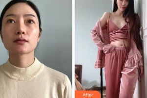 邯鄲曲勝星范醫(yī)療美容門診部顏紅亮整形價格表附切開雙眼皮案例展示