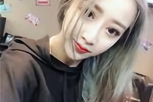 杭州整形醫(yī)院靠譜嗎？附下頜角術(shù)后恢復(fù)過程圖