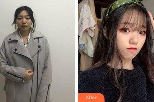 邯鄲市眼科醫(yī)院李景珂整形價格表附切開雙眼皮案例展示