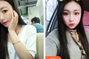 邯鄲凱潤婷整形美容醫(yī)院馬戰(zhàn)勝整形價格表附切開雙眼皮案例展示