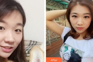 漢口愛爾眼科醫(yī)院李璟整形價格表附眼部綜合案例展示