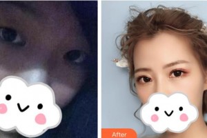 漢口愛爾眼科醫(yī)院姜黎整形價格表附眼部綜合案例展示