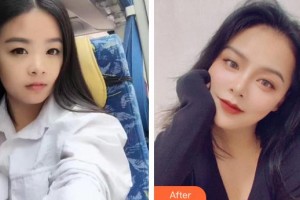 漢口愛爾眼科醫(yī)院常曉可整形價格表附眼部綜合案例展示