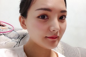 沈陽杏林醫(yī)院整形外科環(huán)境好不好下頜角日記|價格表