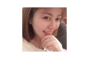 濰坊醫(yī)學(xué)院整形醫(yī)院是公立還是私立？下頜角果過分享