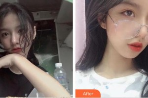 深圳市眼科醫(yī)院劉欣華整形價格表附眼部綜合案例展示