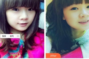 深圳?，斄猪槼毖劭漆t(yī)院施尼可整形價(jià)格表附眼部綜合案例展示