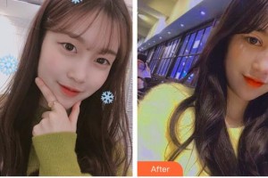 深圳希瑪林順潮眼科醫(yī)院尼思特整形價(jià)格表附眼部綜合案例展示