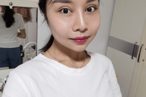 北京麗都醫(yī)療美容醫(yī)院顴弓外擴(kuò)整形果？真實(shí)案例對(duì)比