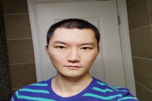 韓國Face-line整形醫(yī)院真人案例分享|2021價(jià)格表